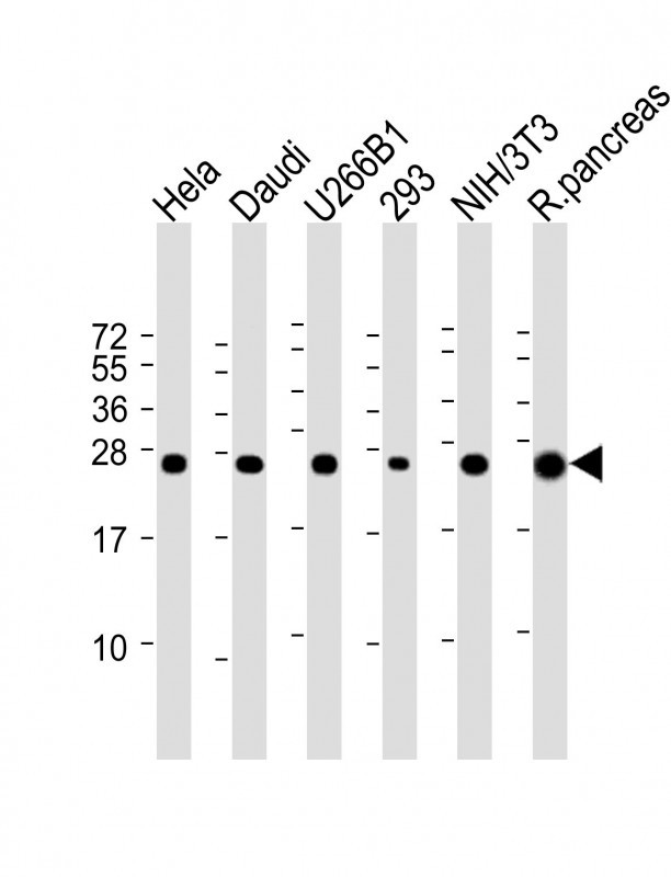 RPL10 (N-term)