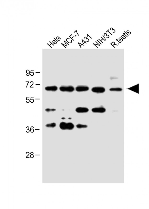 CDC25A (S124)