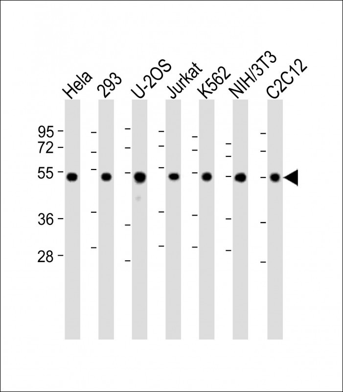 Vimentin