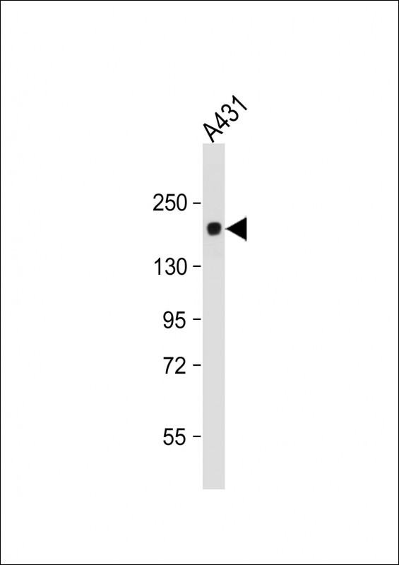 PRDM10