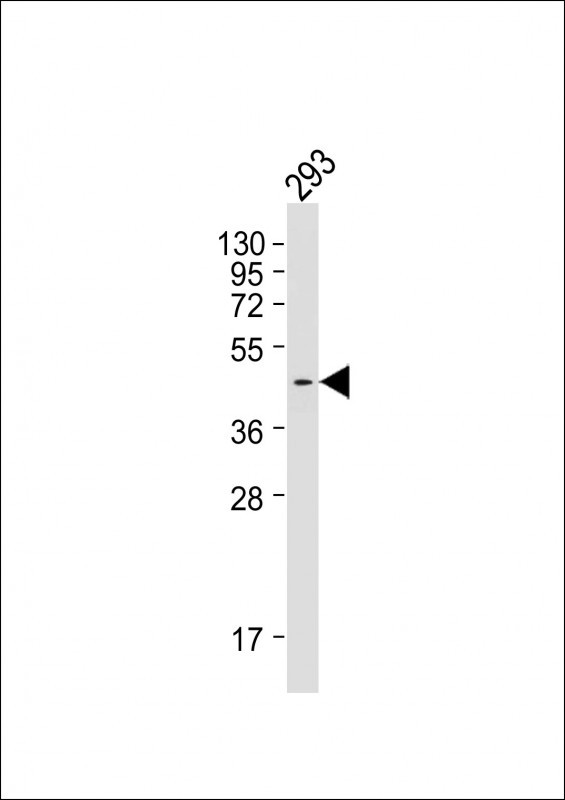 PRDM12