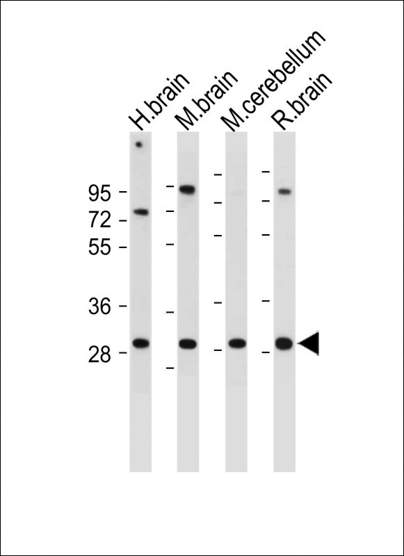 CABP1