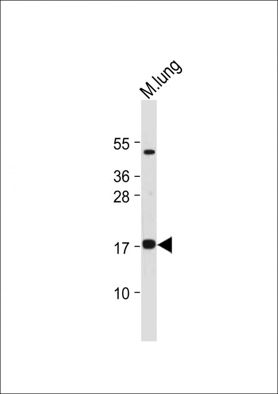 IER3 (N-term)