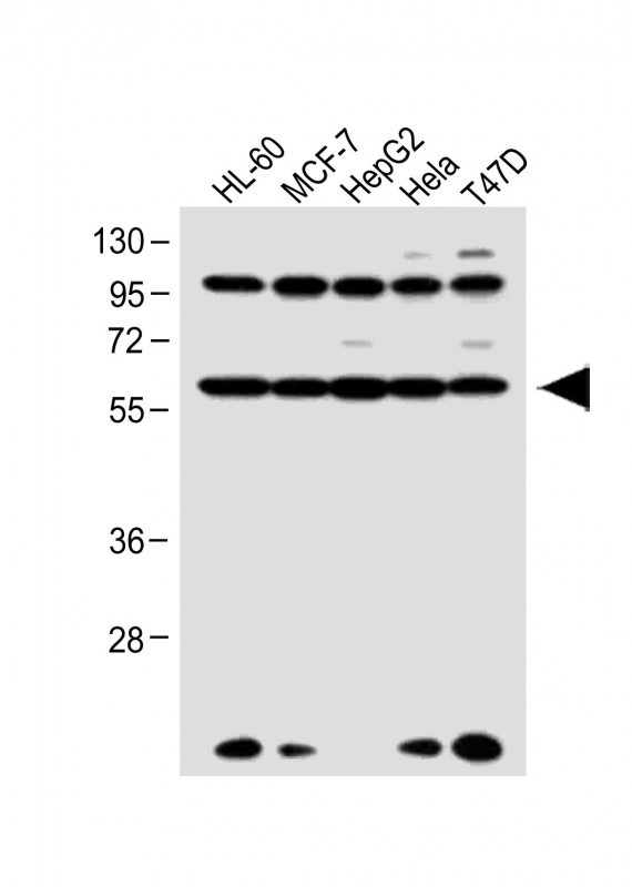 Rabbit Polyclonal Antibody to RARA