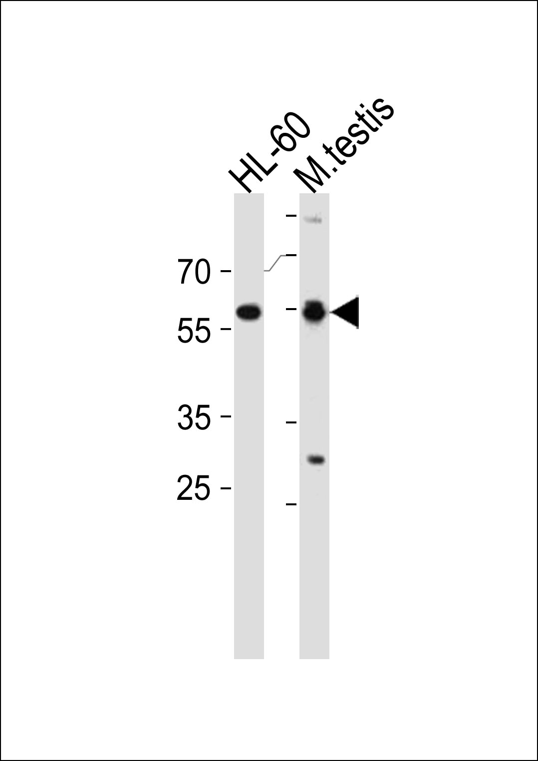Rabbit Polyclonal Antibody to RARA