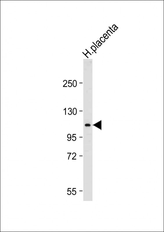 Rabbit Polyclonal Antibody to GAA (N-term)
