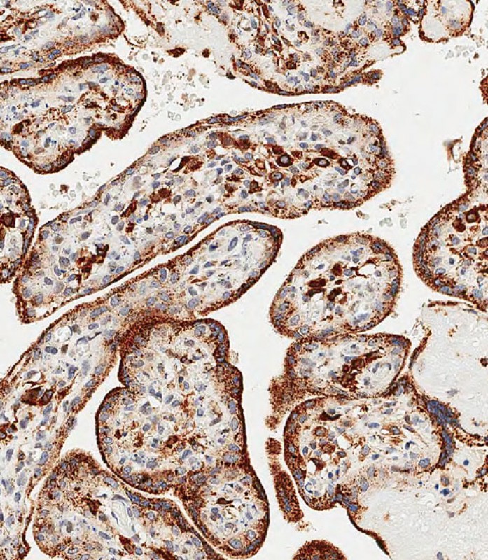 Rabbit Polyclonal Antibody to GAA (N-term)