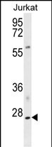 Rabbit Polyclonal Antibody to PHO1 (N-term)