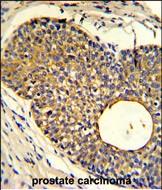 Rabbit Polyclonal Antibody to PHO1 (N-term)