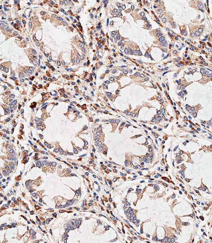 Rabbit Polyclonal Antibody to NOX1