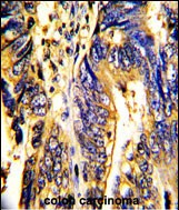 Rabbit Polyclonal Antibody to AXL