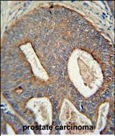 Rabbit Polyclonal Antibody to POTEB