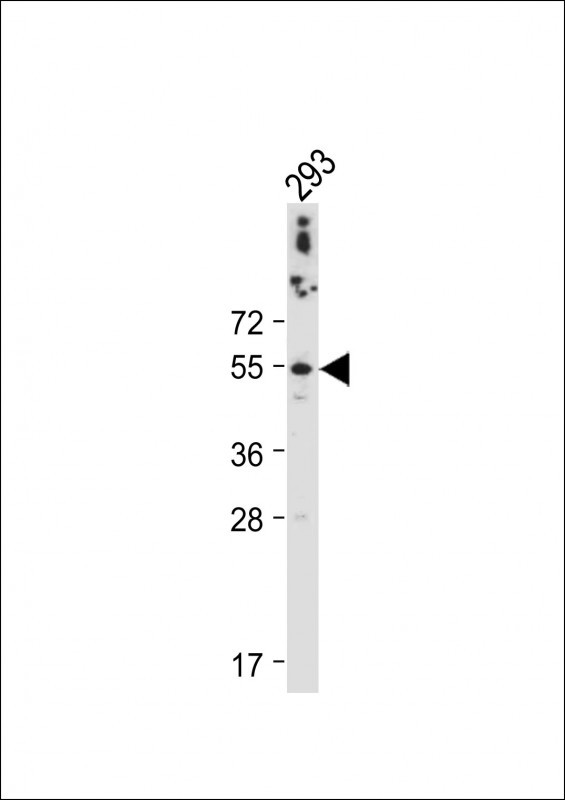 CTSA (N-term)