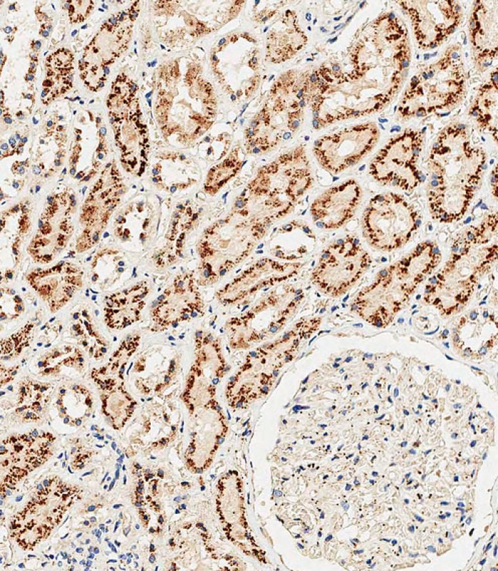 Rabbit Polyclonal Antibody to CTSA (N-term)