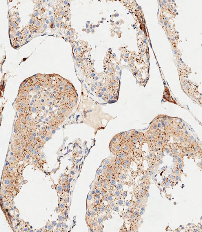 Rabbit Polyclonal Antibody to CTSA (N-term)