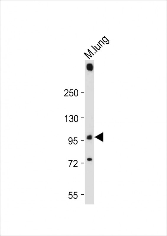 PLD2 (N-term)