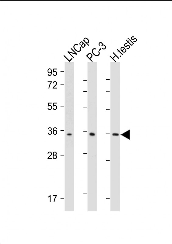 RNF4