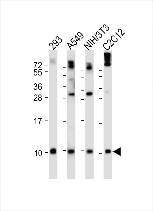 Ubiquitin (N-term)