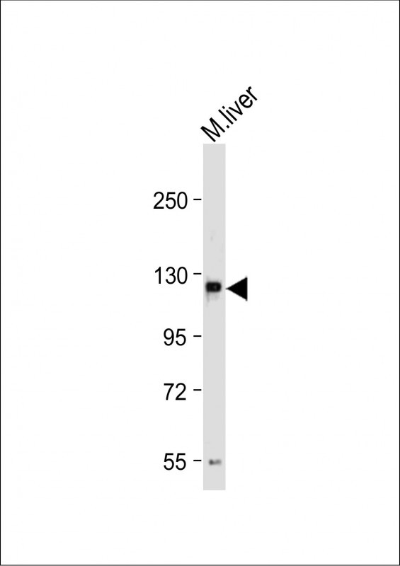M Sema5a  (N-term)