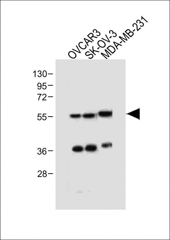 AMHR2 (N-term R80)