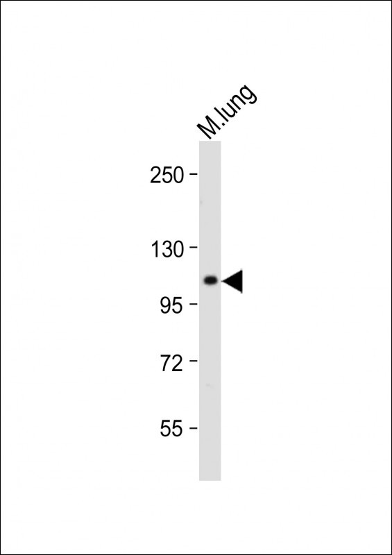 RHBDF2 (N-term)