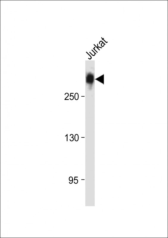 PCM-1