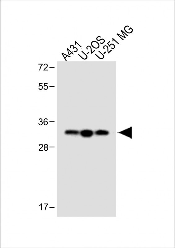Stanniocalcin-2 (STC2) (N-term)