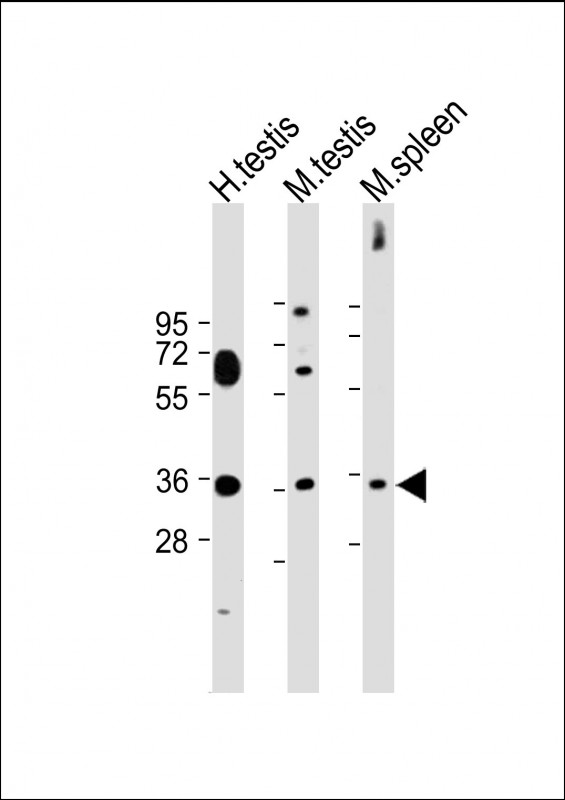 ASB17  (C-term)