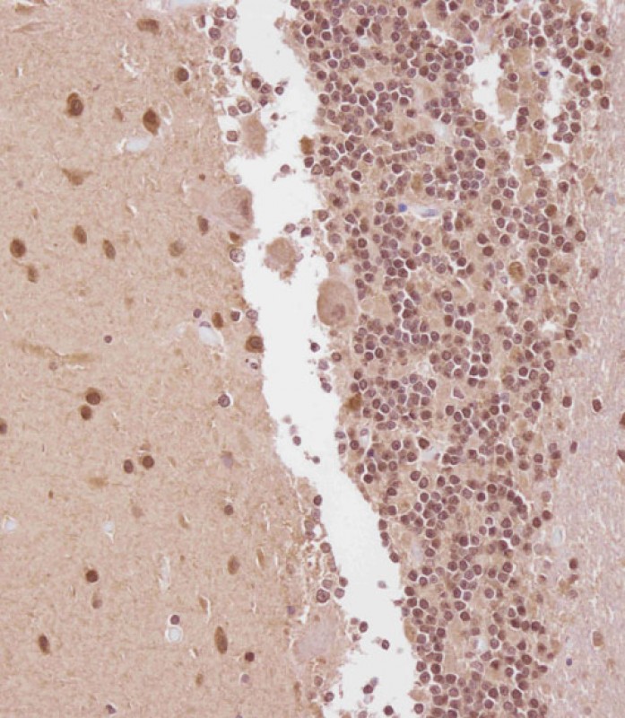 Rabbit Polyclonal Antibody to ELAVL2