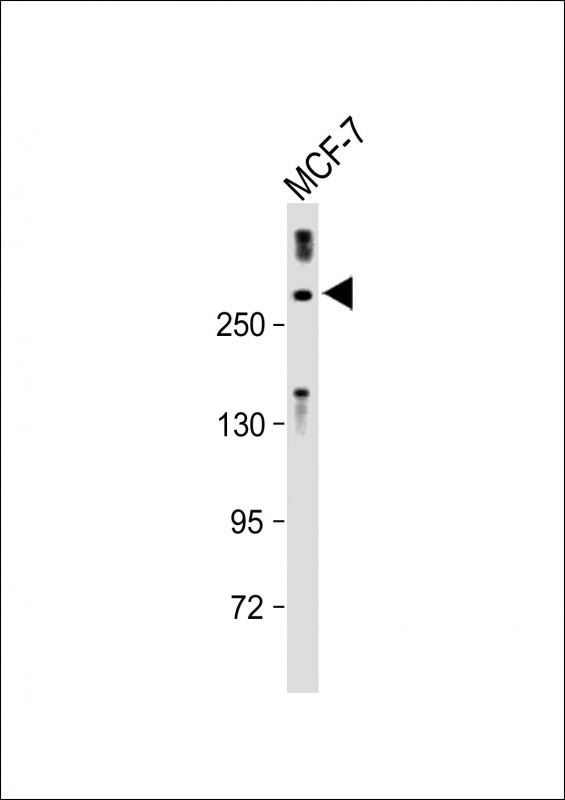 TET2 (N-term)