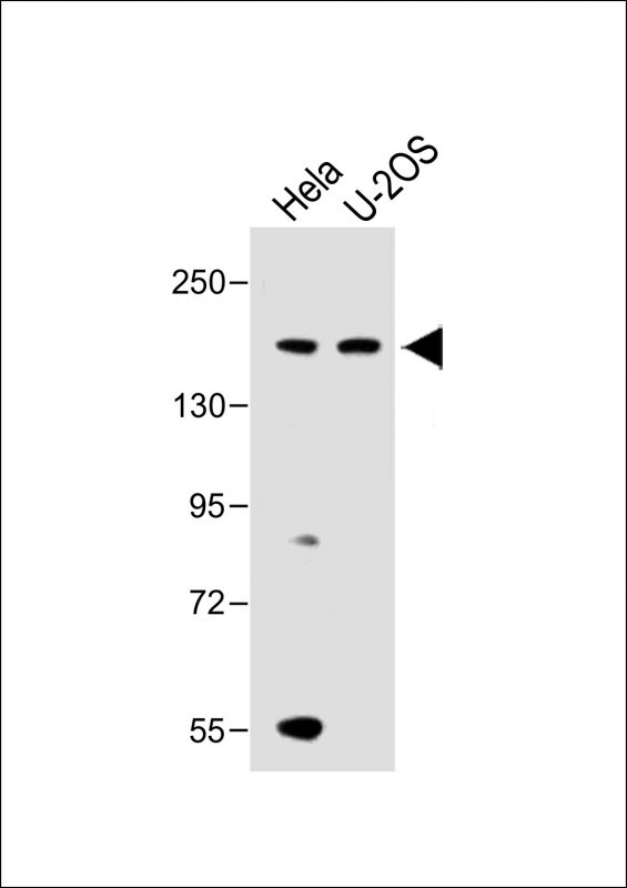 KDM6B (N-term)