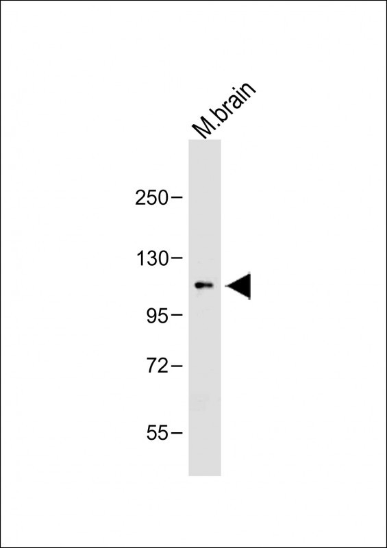 OTUD7A (N-term)