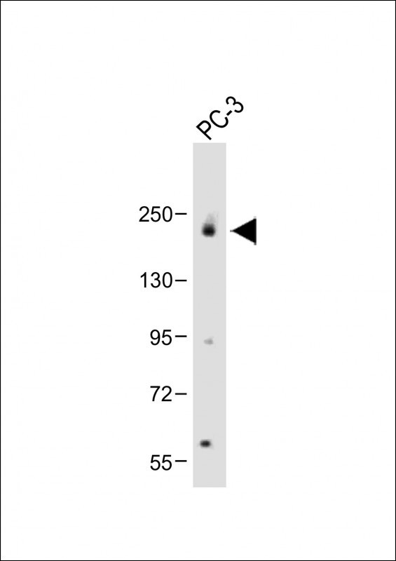 JLP (SPAG9) (N-term)