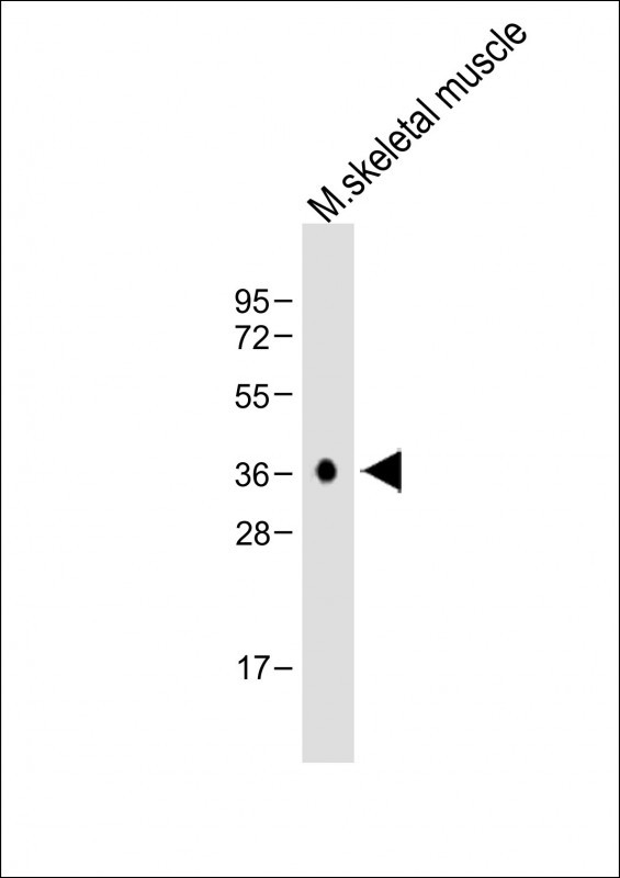 CTSK (Center R222)