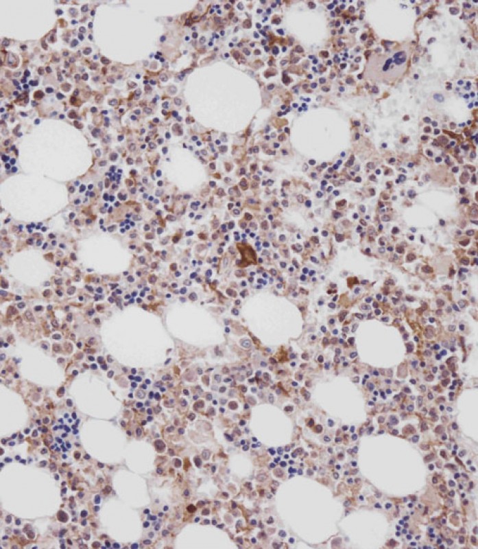 Rabbit Polyclonal Antibody to CTSK (Center R222)