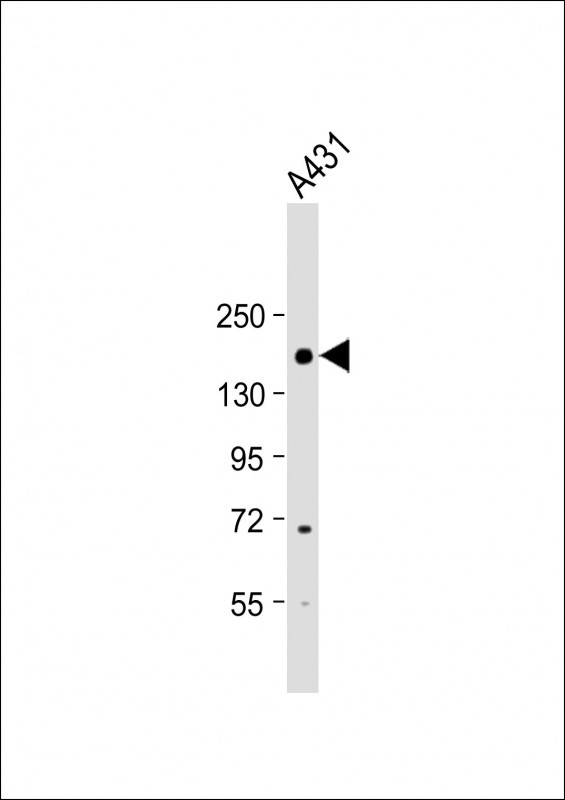 CCK4 (PTK7) (N-term)