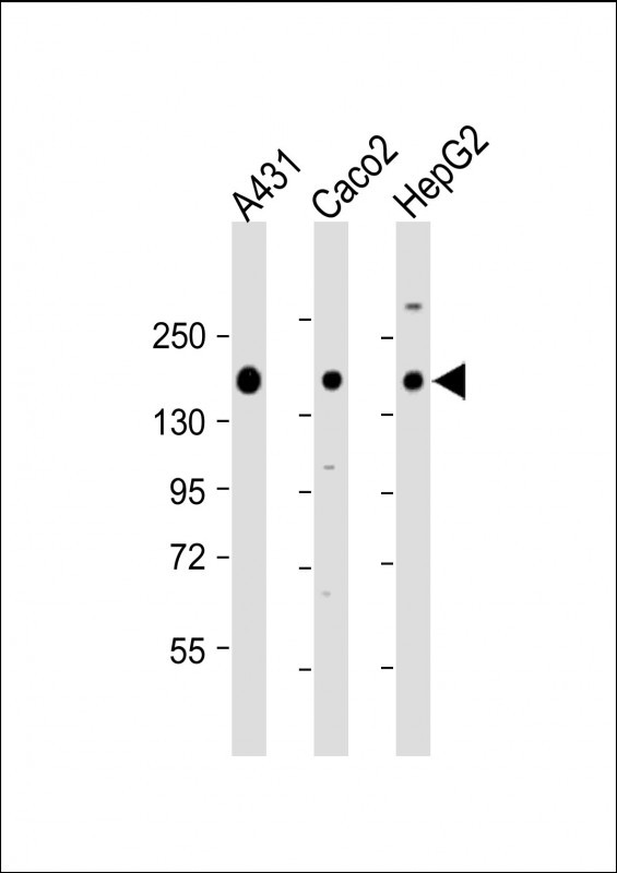 Rabbit Polyclonal Antibody to CCK4 (PTK7) (N-term)