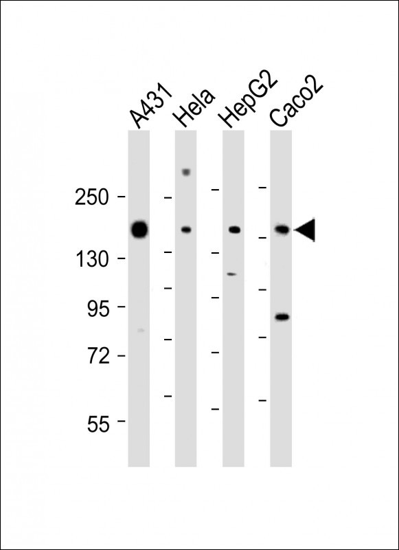 Rabbit Polyclonal Antibody to CCK4 (PTK7) (N-term)