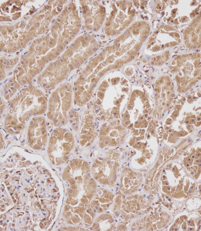 Rabbit Polyclonal Antibody to SERPINA6