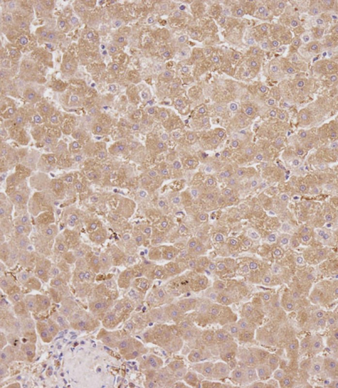 Rabbit Polyclonal Antibody to SERPINA6