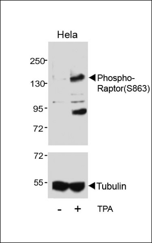 Phospho-Raptor(S863)