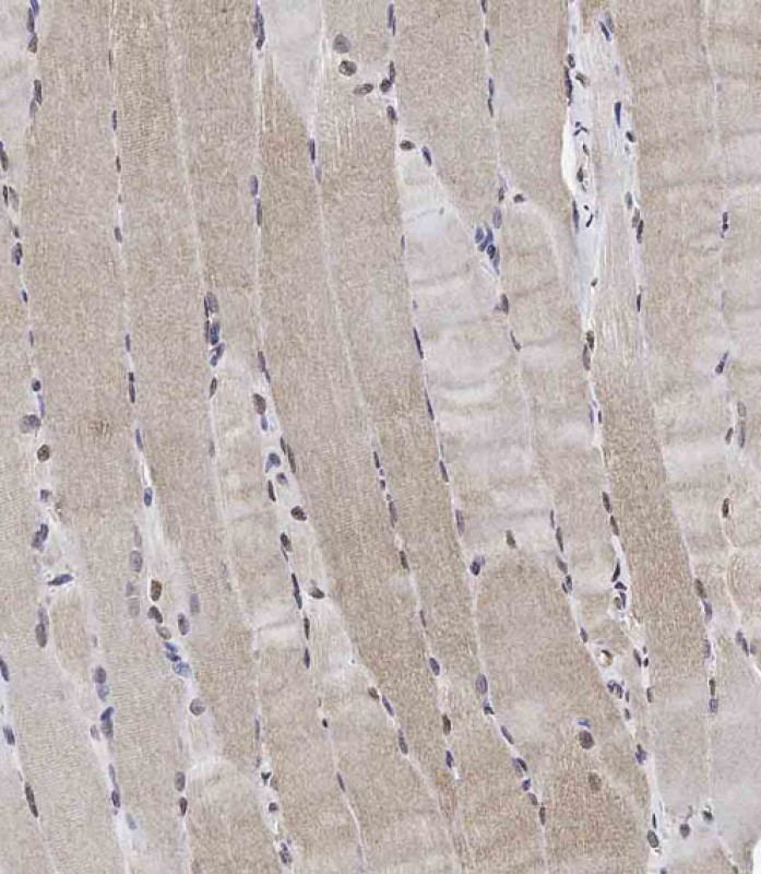 Rabbit Polyclonal Antibody to Phospho-Raptor(S863)