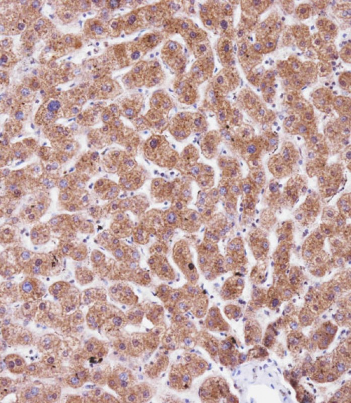 Rabbit Polyclonal Antibody to PEMT