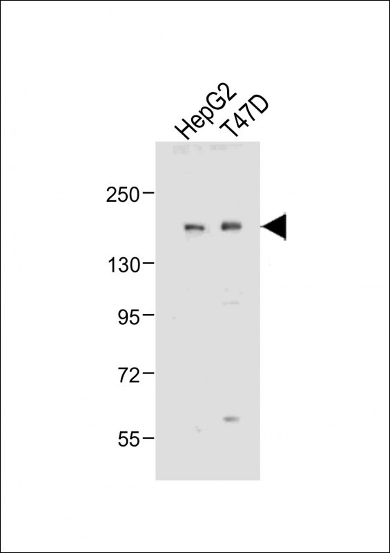 HDAC6