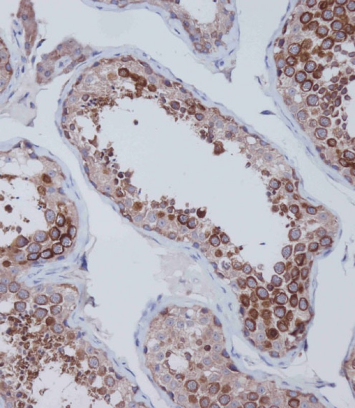 Rabbit Polyclonal Antibody to HDAC6