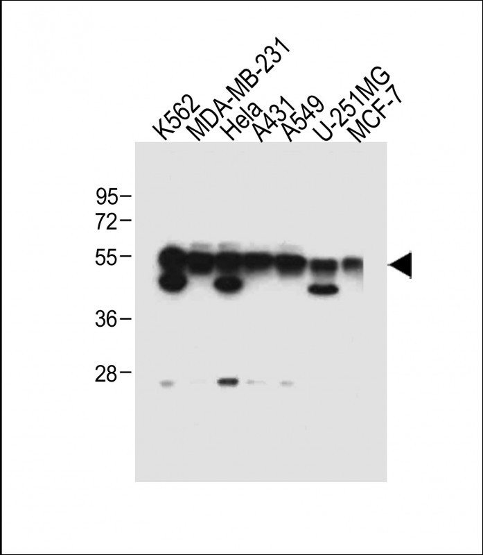 Rabbit Polyclonal Antibody to TUBB6