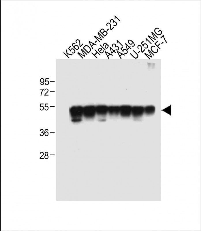 Rabbit Polyclonal Antibody to TUBB6