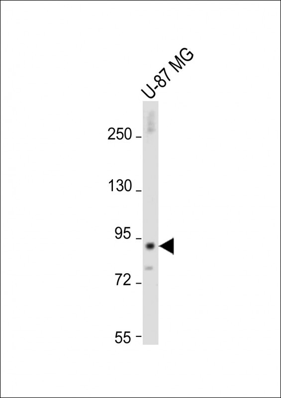 DTNA