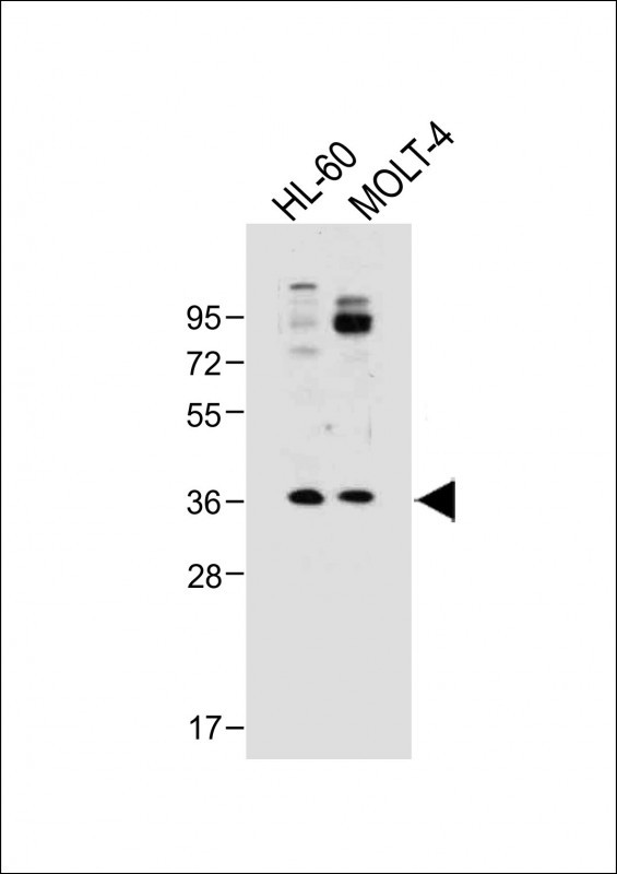 RQCD1