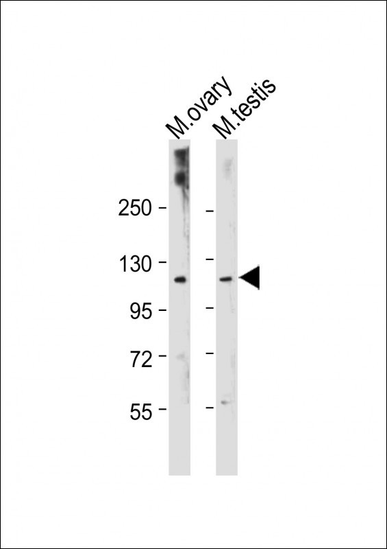 Mouse Lats2(C-term)